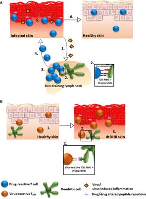 Skin Resident Memory T Cells May Play Critical Role in Delayed-Type Drug Hypersensitivity Reactions